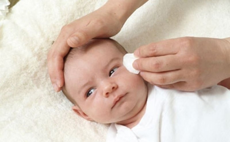 Mẹ nhỏ sữa vào mắt: Bé sơ sinh nhập viện sau 4 ngày